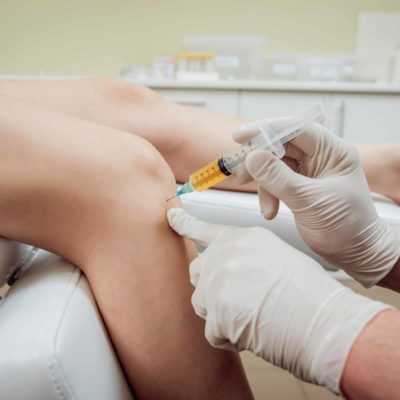 Platelet-Rich Plasma Treatment Universal Wellness Source Platelet-Rich Plasma Treatment Universal Wellness Source
